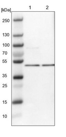 DDX47 Antibody, Novus Biologicals 0.1mL; Unlabeled:Antibodies, Polyclonal