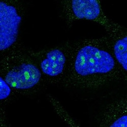 DDX50 Antibody, Novus Biologicals 0.1mL; Unlabeled:Antibodies, Polyclonal