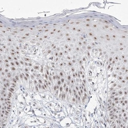 DDX50 Antibody, Novus Biologicals 0.1mL; Unlabeled:Antibodies, Polyclonal