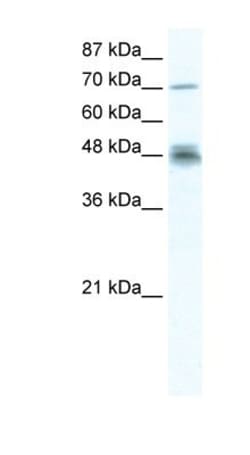 DDX50 Antibody, Novus Biologicals 100&mu;L; Unlabeled:Antibodies, Polyclonal