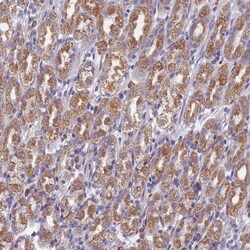 DDX51 Antibody, Novus Biologicals 0.1mL; Unlabeled:Antibodies, Polyclonal