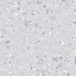 DDX54 Antibody, Novus Biologicals 25 &mu;L; Unlabeled:Antibodies, Polyclonal