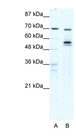 DDX55 Antibody, Novus Biologicals 100&mu;L; Unlabeled:Antibodies, Polyclonal