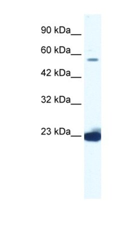 DDX55 Antibody, Novus Biologicals 100&mu;L; Unlabeled:Antibodies, Polyclonal