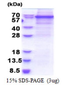 Novus Biologicals&trade;&nbsp;Recombinant Human DDX56 His Protein