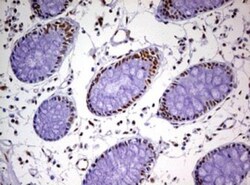 DDX56 Antibody (OTI2E5), Novus Biologicals 0.1mL; Unlabeled:Antibodies,