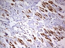 DDX56 Antibody (OTI2E5), Novus Biologicals 0.1mL; Unlabeled:Antibodies,