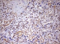 DDX56 Antibody (OTI2E5), Novus Biologicals 0.1mL; Unlabeled:Antibodies,