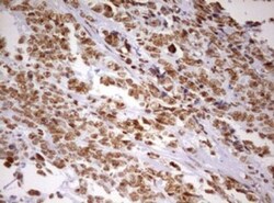 DDX56 Antibody (OTI2E5), Novus Biologicals 0.1mL; Unlabeled:Antibodies,