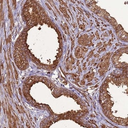 DDX59 Antibody, Novus Biologicals:Antibodies:Primary Antibodies
