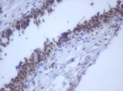 DDX59 Antibody (OTI2G1), Novus Biologicals 0.1mL; Unlabeled:Antibodies,