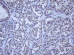 DDX59 Antibody (OTI2G1), Novus Biologicals 0.1mL; Unlabeled:Antibodies,