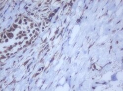 DDX59 Antibody (OTI2G1), Novus Biologicals 0.1mL; Unlabeled:Antibodies,