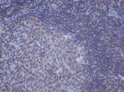 DDX59 Antibody (OTI2G1), Novus Biologicals 0.1mL; Unlabeled:Antibodies,