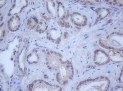 DDX59 Antibody (OTI2G1), Novus Biologicals 0.1mL; Unlabeled:Antibodies,