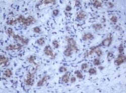 DDX59 Antibody (OTI2G1), Novus Biologicals 0.1mL; Unlabeled:Antibodies,