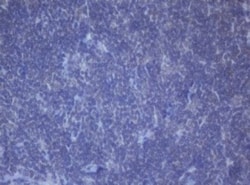 DDX59 Antibody (OTI2G1), Novus Biologicals 0.1mL; Unlabeled:Antibodies,