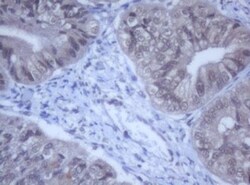 DDX59 Antibody (OTI2G1), Novus Biologicals 0.1mL; Unlabeled:Antibodies,