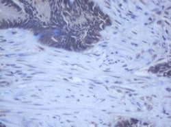 DDX59 Antibody (OTI2G1), Novus Biologicals 0.1mL; Unlabeled:Antibodies,