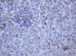DDX59 Antibody (OTI2G1), Novus Biologicals 0.1mL; Unlabeled:Antibodies,