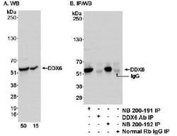 DDX6 Antibody, Novus Biologicals 0.1mL; Unlabeled:Antibodies, Polyclonal