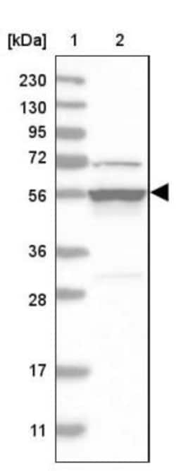 DDX6 Antibody, Novus Biologicals 0.1mL; Unlabeled:Antikroppar