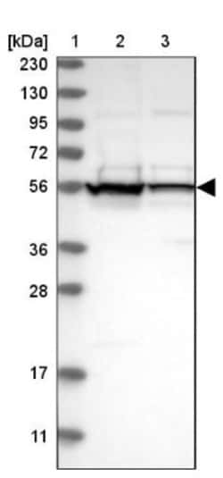 DDX6 Antibody, Novus Biologicals:Antibodies:Primary Antibodies