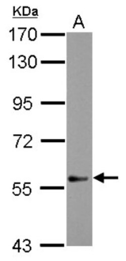 DEAF1 Antibody, Novus Biologicals 0.1mL; Unlabeled:Antibodies, Polyclonal