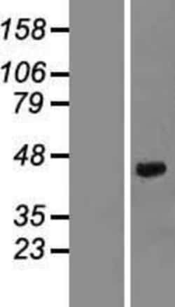 Novus Biologicals&trade;&nbsp;Decorin Overexpression Lysate