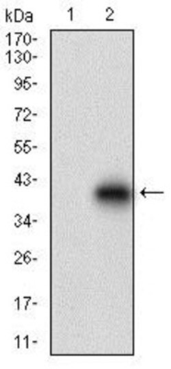 Decorin Antibody (5E8E7) - BSA Free, Novus Biologicals:Antibodies:Primary