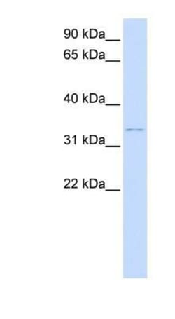 Decorin Antibody, Novus Biologicals 0.05mg; Unlabeled:Antibodies, Polyclonal