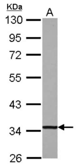 DECR1 Antibody, Novus Biologicals 0.1mL; Unlabeled:Antibodies, Polyclonal