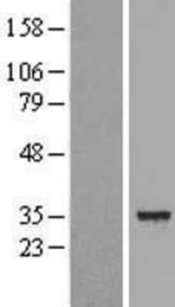 Novus Biologicals&trade;&nbsp;DECR1 Overexpression Lysate