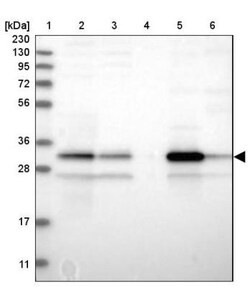 DECR1 Antibody, Novus Biologicals:Antibodies:Primary Antibodies