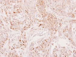 DECR2 Antibody, Novus Biologicals 0.1mL; Unlabeled:Antibodies, Polyclonal