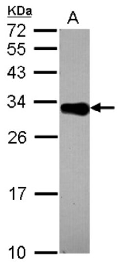 DECR2 Antibody, Novus Biologicals 0.1mL; Unlabeled:Antibodies, Polyclonal
