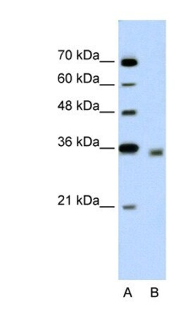 DECR2 Antibody, Novus Biologicals 100&mu;L; Unlabeled:Antibodies, Polyclonal