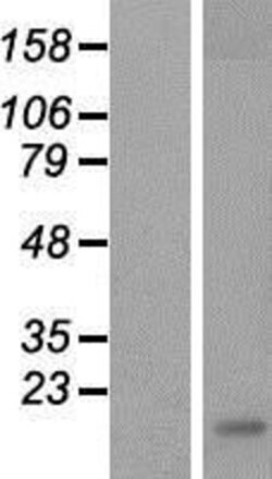 Novus Biologicals&trade;&nbsp;Dectin-1/CLEC7A Overexpression Lysate
