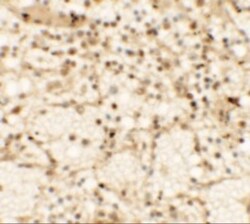 Dectin-1/CLEC7A Antibody - BSA Free, Novus Biologicals 0.025 mg, Unlabeled:Antibodies,