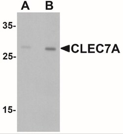 Dectin-1/CLEC7A Antibody - BSA Free, Novus Biologicals 0.025 mg, Unlabeled:Antibodies,
