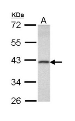 DEDD Antibody, Novus Biologicals 0.1mL; Unlabeled:Antibodies, Polyclonal