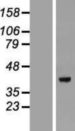 Novus Biologicals&trade;&nbsp;DEDD Overexpression Lysate