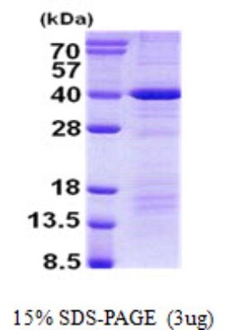 Novus Biologicals&trade;&nbsp;Recombinant Human DEDD His Protein