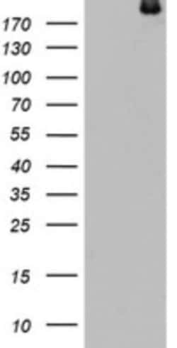 dedicator of cytokinesis 8 Antibody (OTI12D7), Novus Biologicals 0.1mL;