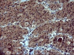 dedicator of cytokinesis 8 Antibody (OTI4F3), Novus Biologicals 0.1mL;