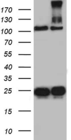 dedicator of cytokinesis 8 Antibody (OTI4H10), Novus Biologicals 0.1mL;