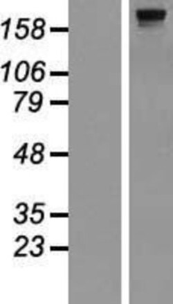 Novus Biologicals&trade;&nbsp;dedicator of cytokinesis 8 Overexpression Lysate