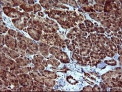 dedicator of cytokinesis 8 Antibody (OTI4F3), Novus Biologicals 0.1mL;