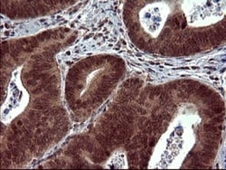 dedicator of cytokinesis 8 Antibody (OTI4F3), Novus Biologicals 0.1mL;