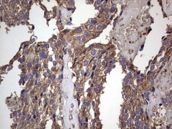 dedicator of cytokinesis 8 Antibody (OTI4H10), Novus Biologicals 0.1mL;